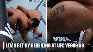 Igor Severino DQ’d for biting Andre Lima on #UFCVegas89 prelims | ESPN MMA
